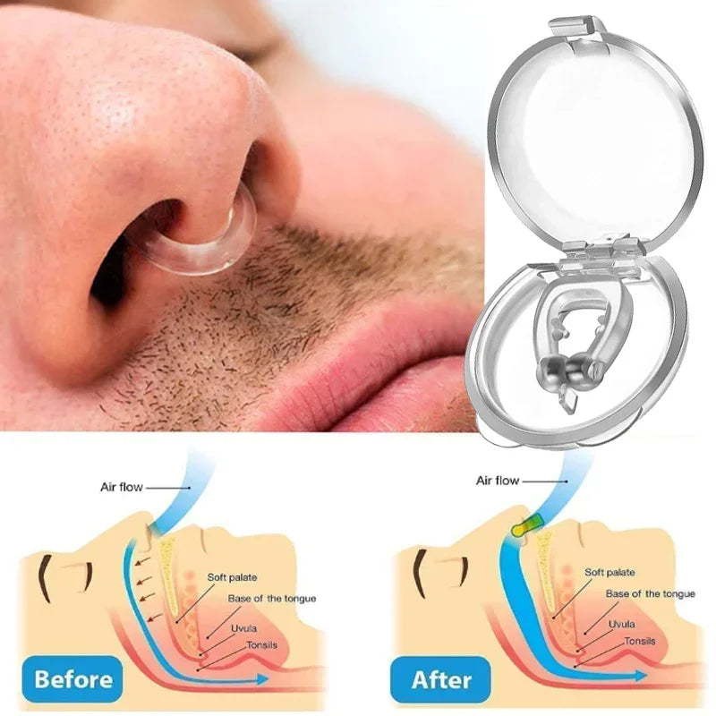 SilentEase Anti-Snore Nose Clip