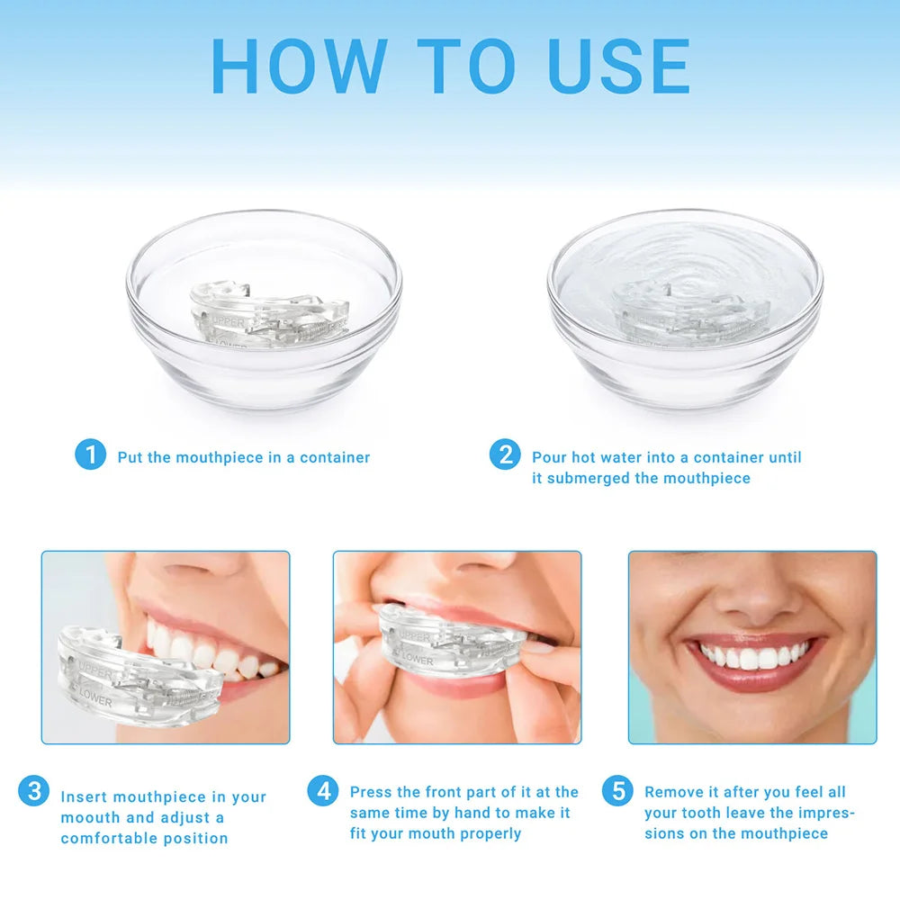 SilentGuard: Anti-Snoring & Bruxism Mouthpiece